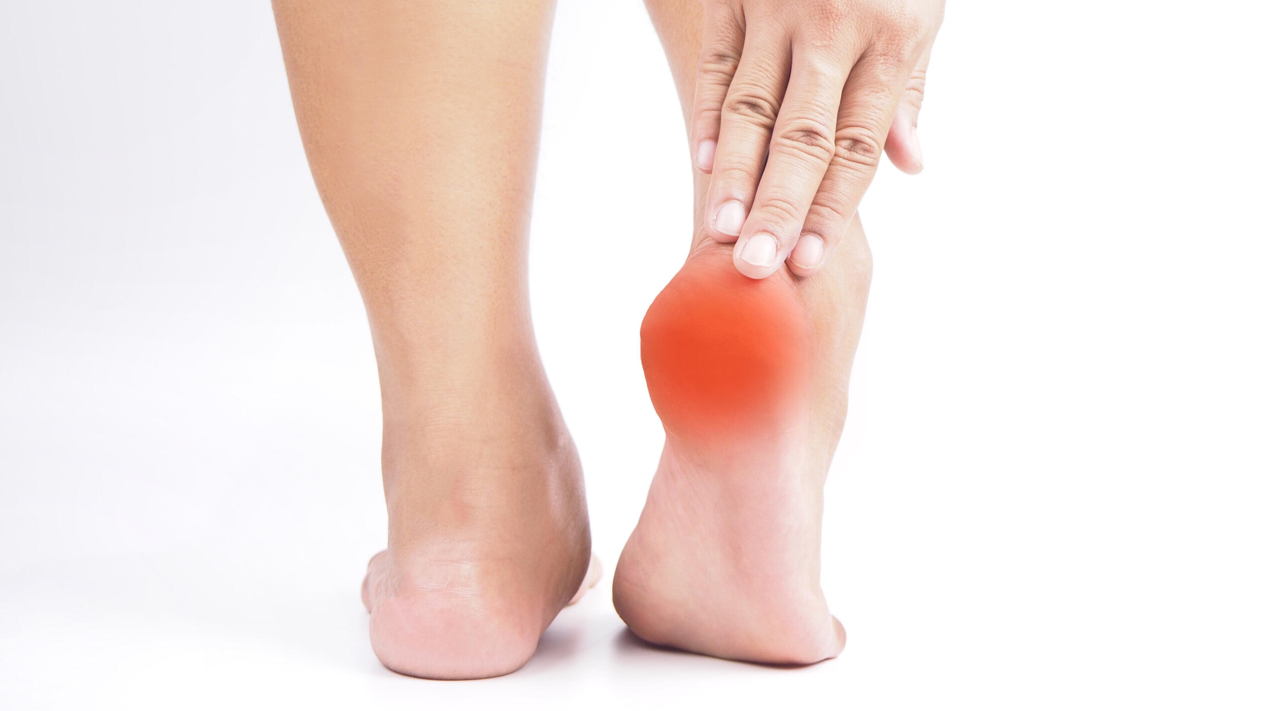Plantar Fasciitis